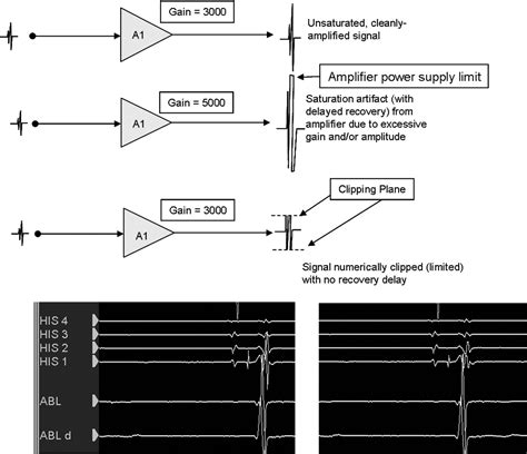 Signals and Signal Processing for the Electrophysiologist.